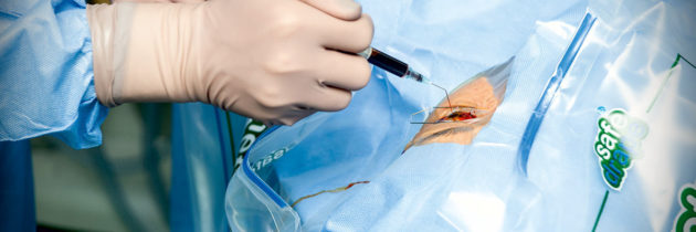 Współczesne możliwości  chirurgicznej  korekcji wad wzroku